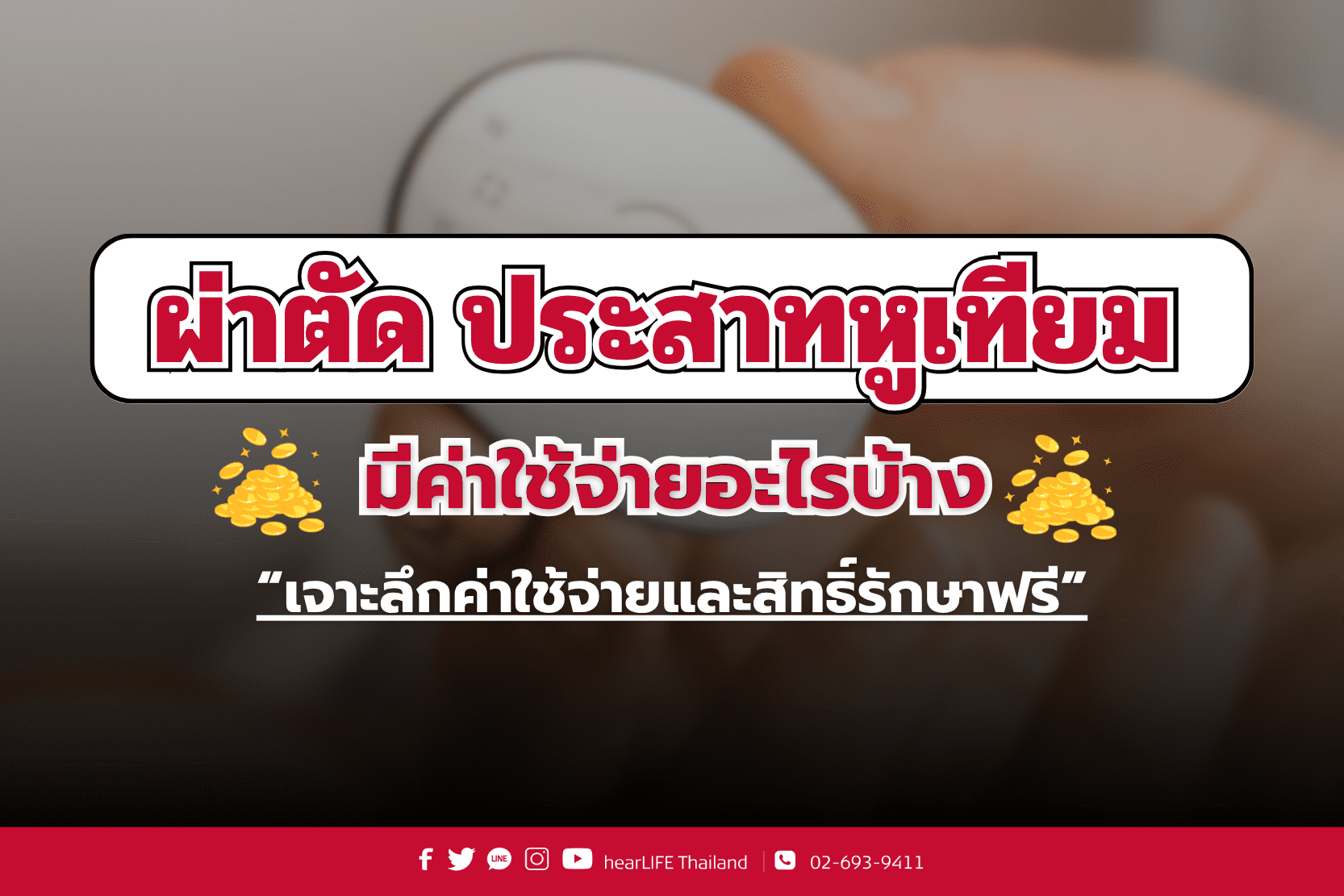 ประสาทหูเทียม