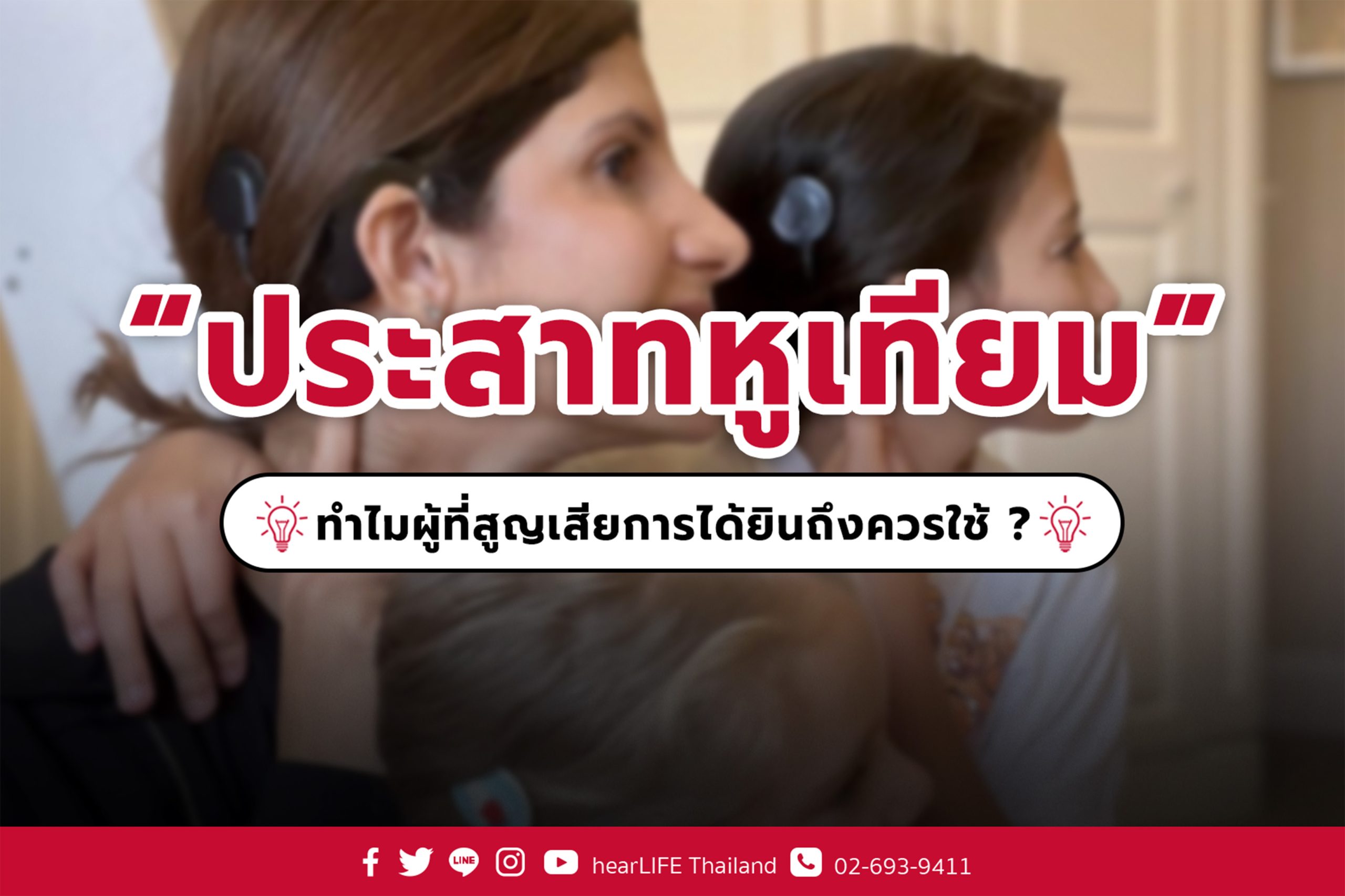 ประสาทหูเทียม